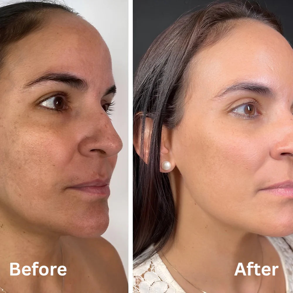 Alenora's Beauty Peel Shot - White + Black Rice Set