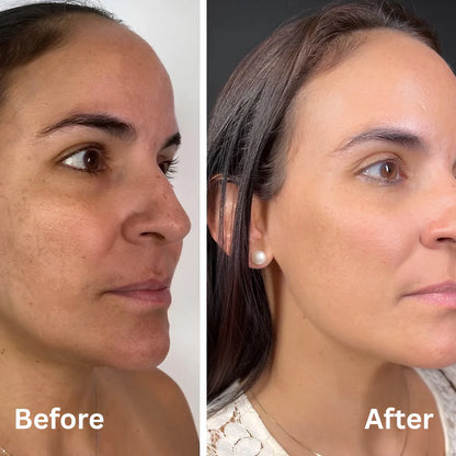 Alenora's Beauty Peel Shot - White + Black Rice Set