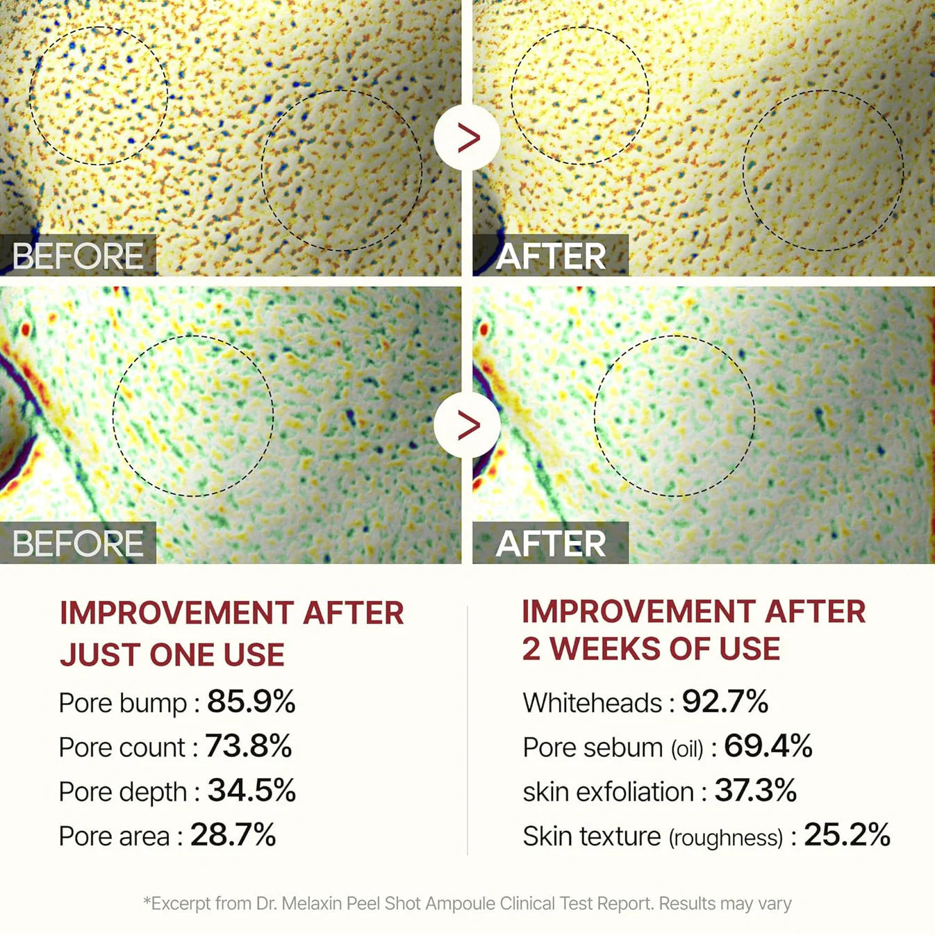 Alenora's Beauty Peel Shot - White + Black Rice Set